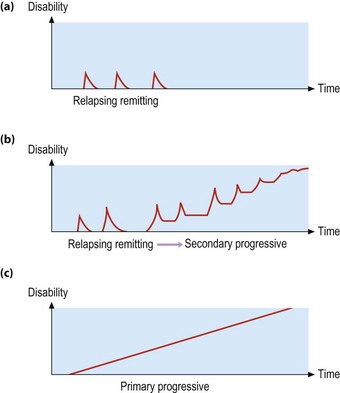 Multiple Sclerosis I Neupsy Key