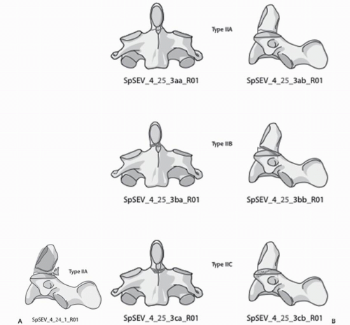 Odontoid Fractures Neupsy Key