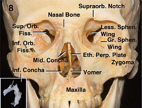 Anatomical Basis of Skull Base Surgery: Skull Osteology | Neupsy Key