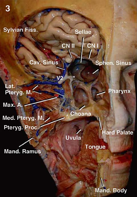 Anatomy of the Nasal Cavity and Paranasal Sinuses | Neupsy Key