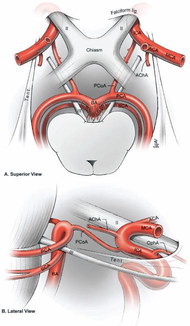 Posterior Cerebral Artery Pca Stepwards Arteries Arteries Sexiz Pix