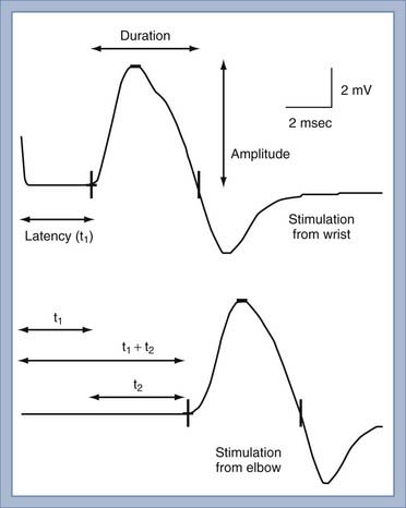 Electrodiagnostic Evaluation of Peripheral Nerves  Neupsy Key