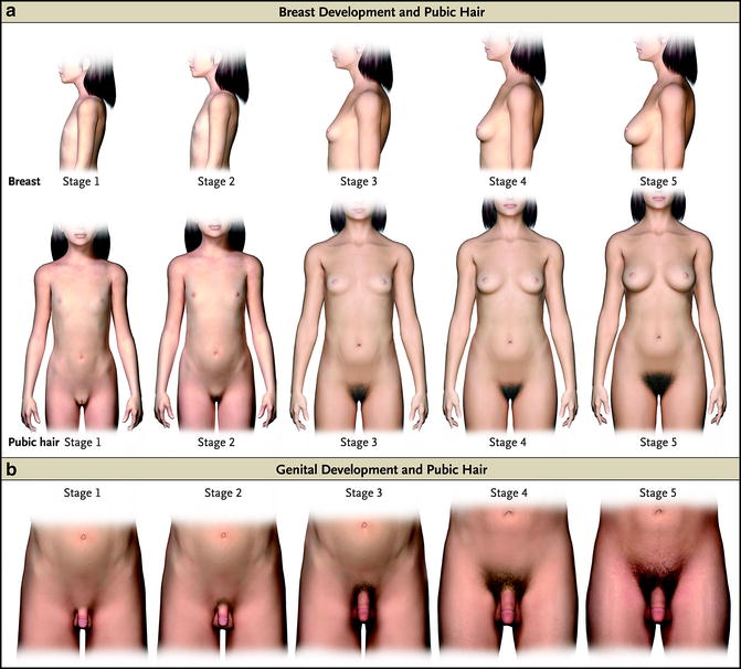 Puberty Ideas Puberty Puberty Girls Puberty Girls Stages The Best Porn Website