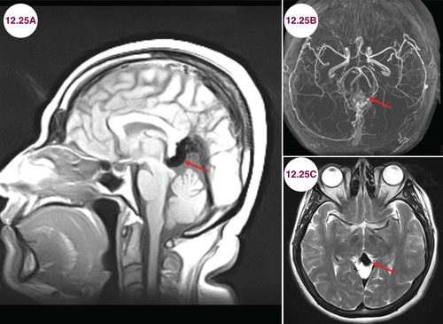 Pediatrics | Neupsy Key