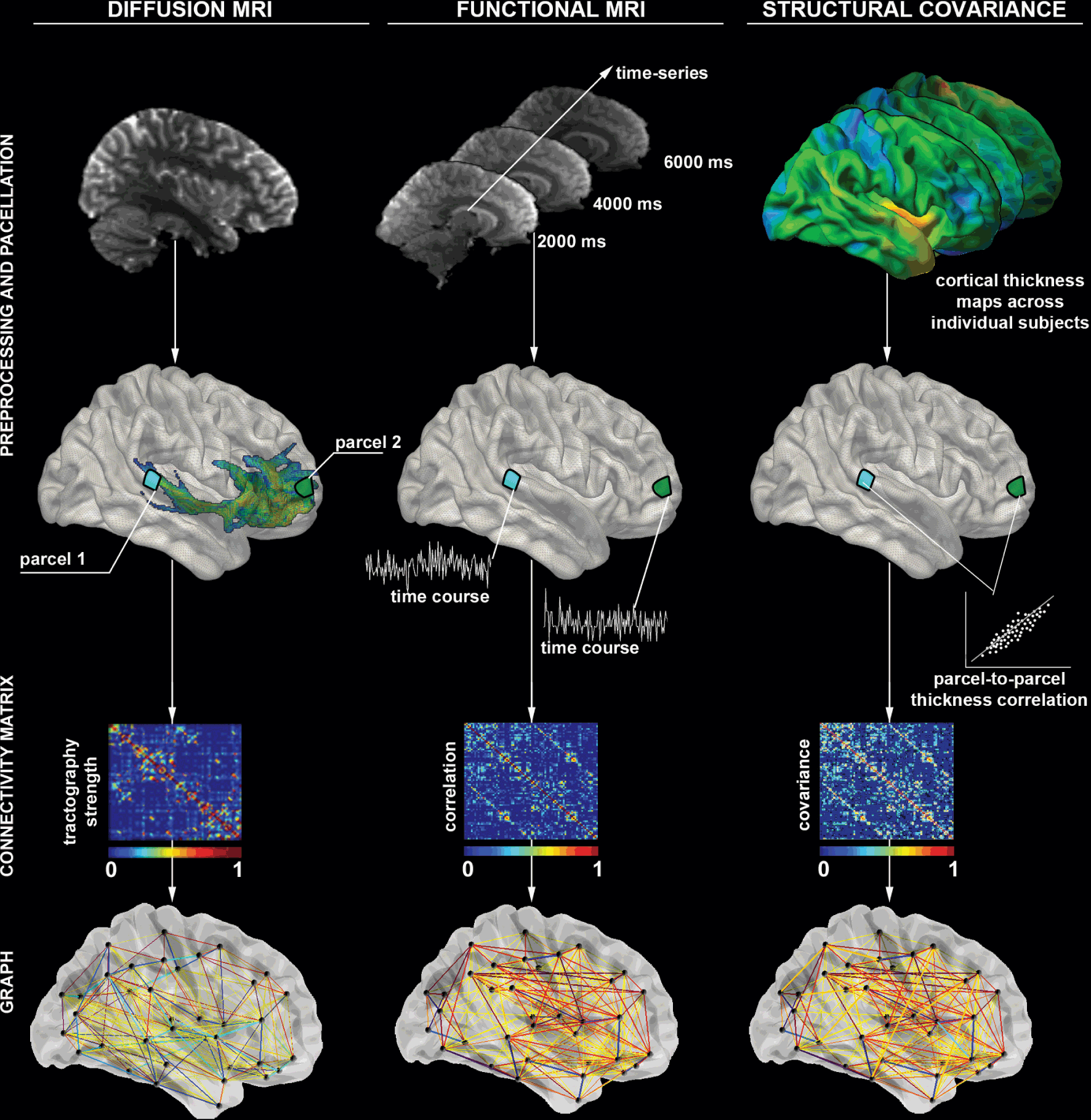 Chapter 8 – Network Modeling of Epilepsy Using Structural and ...