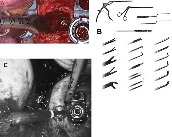 Fig. 2.5