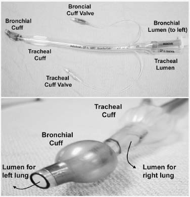 Anesthetic Considerations and Operating Room Setup for Minimally ...