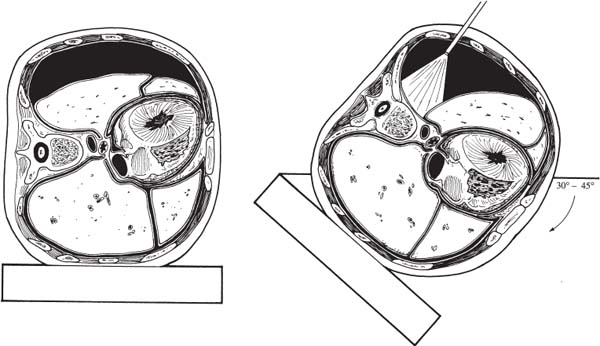 Fig. 3.2