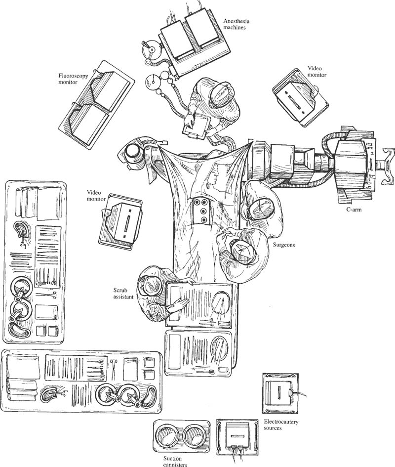 Anesthetic Considerations And Operating Room Setup For