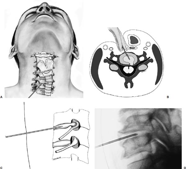 Fig. 5–4