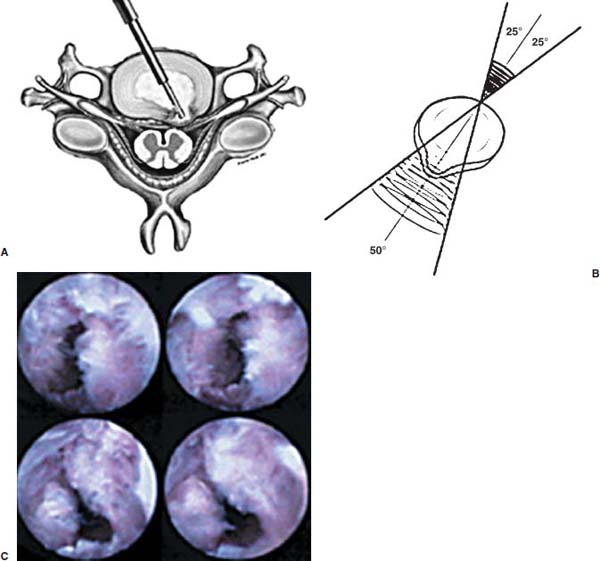 Fig. 5–7