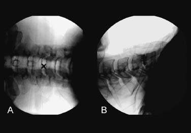 Fig. 6–8