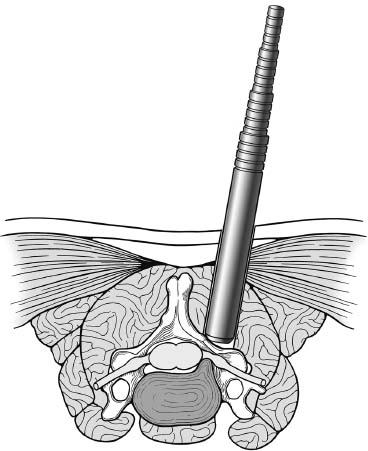 Fig. 7–3