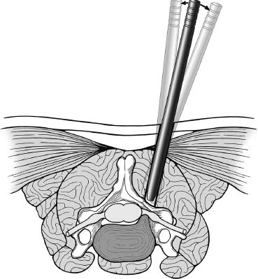 Fig. 7–4