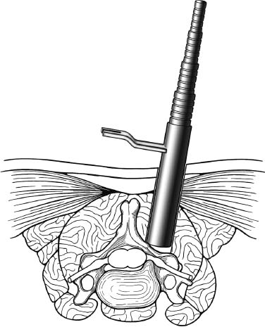 Fig. 7–5