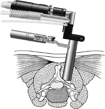 Fig. 7–6