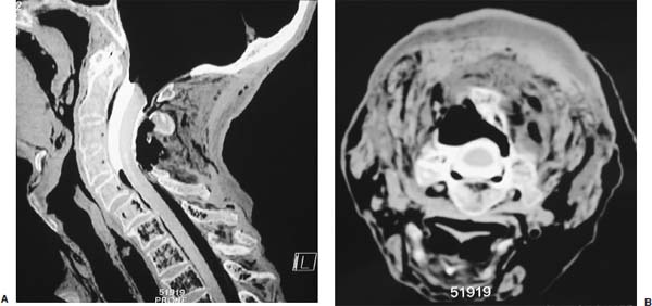 Fig. 8–6