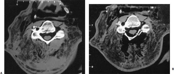 Fig. 8–9