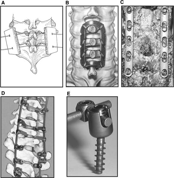 Fig. 9–1