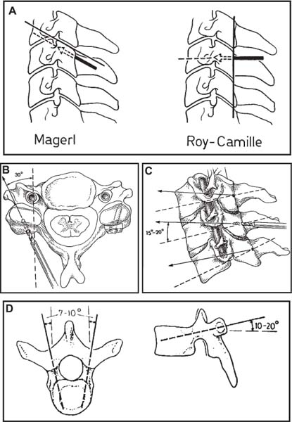 Fig. 9–2