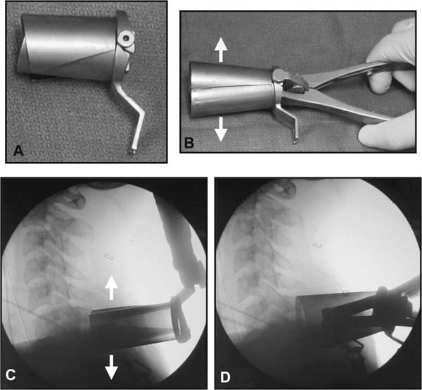 Fig. 9–7