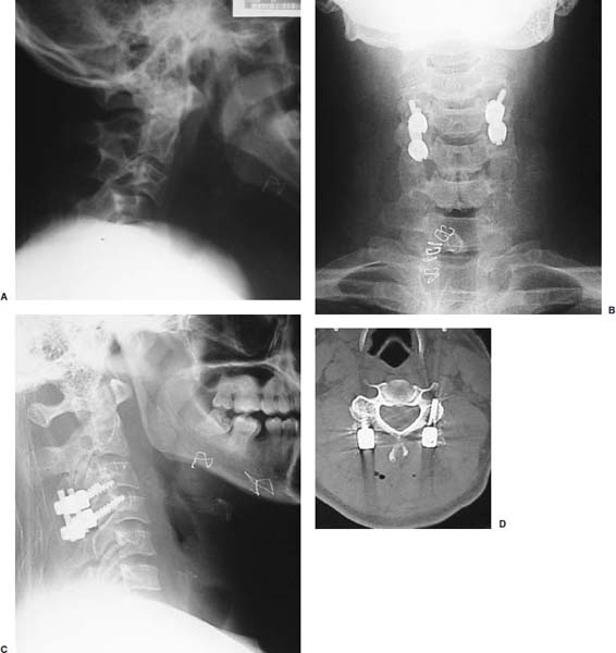 Fig. 9–14