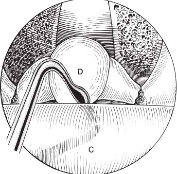 FIGURE 12–5