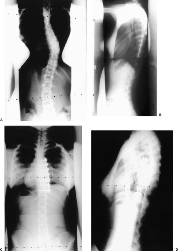 FIGURE 14–24