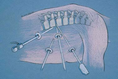 FIGURE 16–4