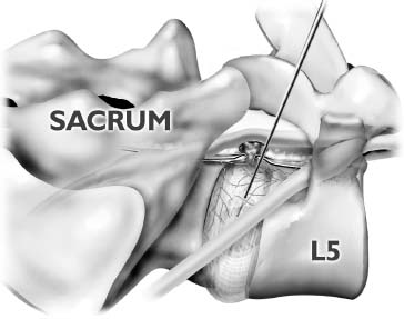 FIGURE 18–1