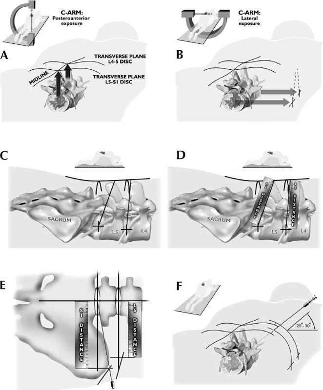 FIGURE 18–4