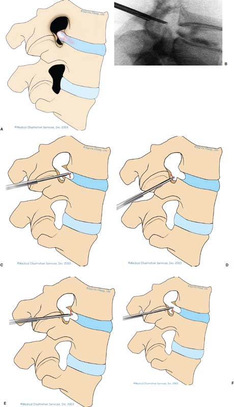 FIGURE 19–6