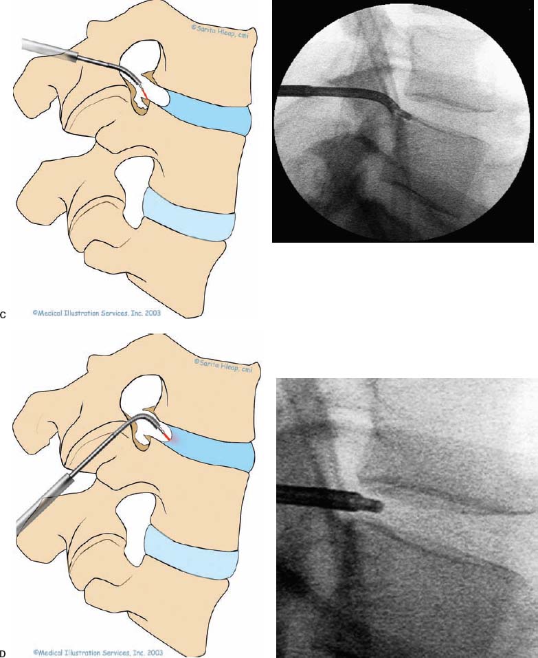 FIGURE 19–7a