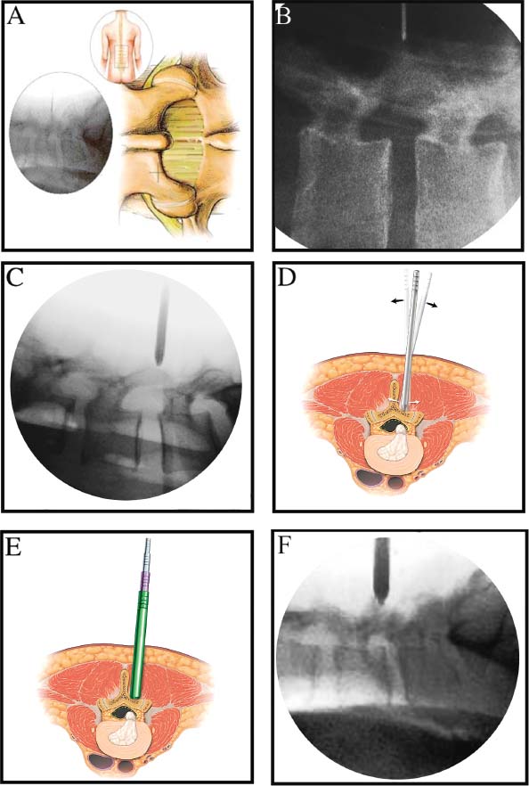 FIGURE 20–3