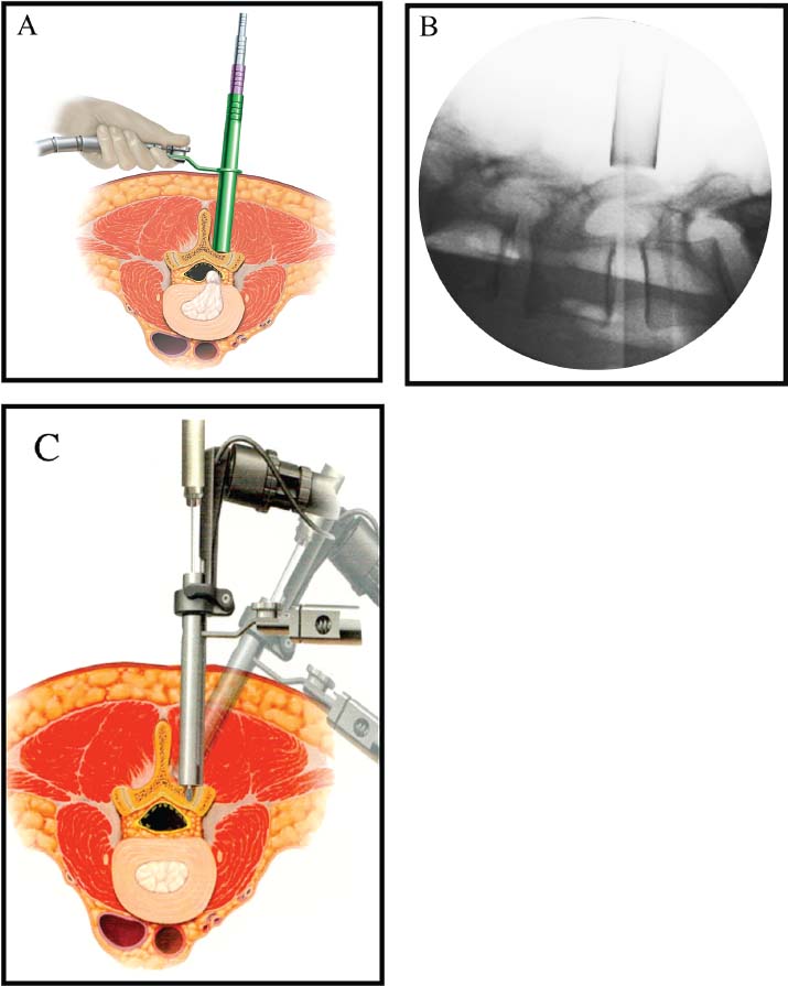 FIGURE 20–4