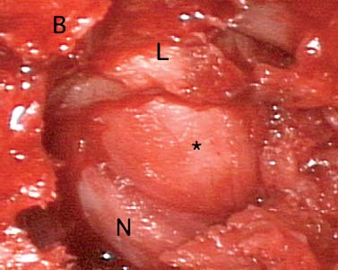 FIGURE 21–4