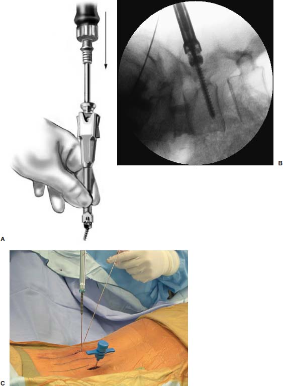 FIGURE 23–8