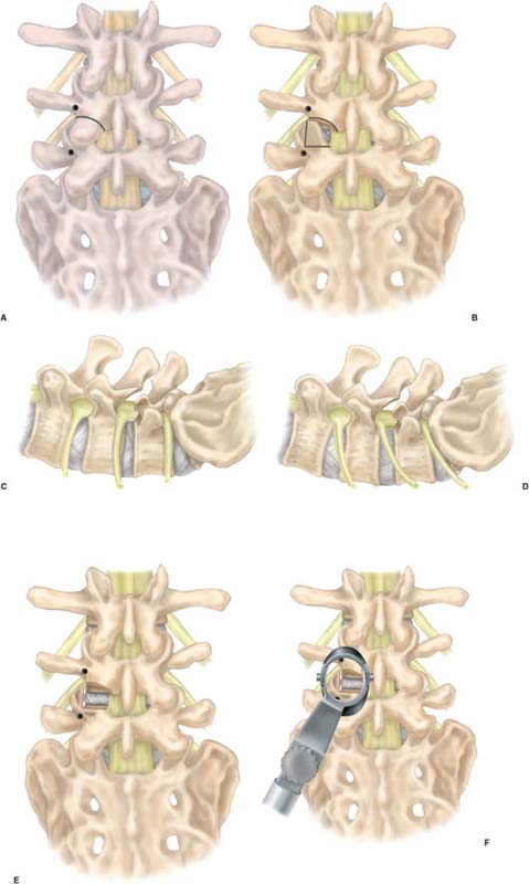 FIGURE 24–6