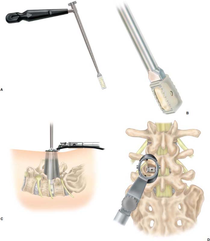 FIGURE 24–10