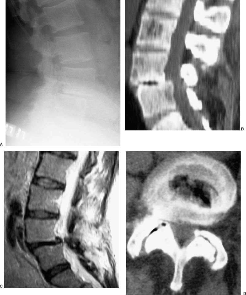 FIGURE 24–13