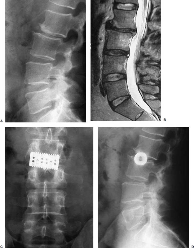 Fig. 27.1