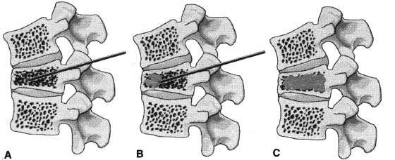 Fig. 29–1