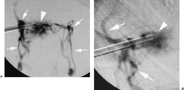 Fig. 29–9