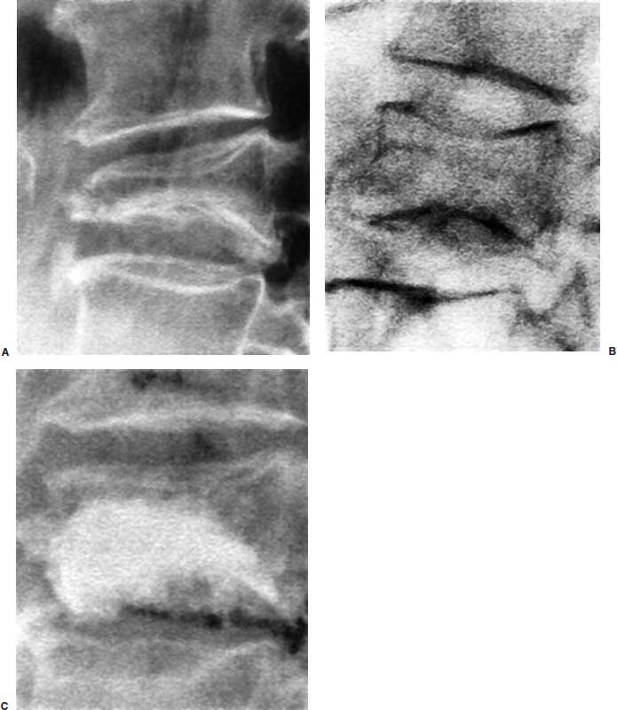 Fig. 29–11