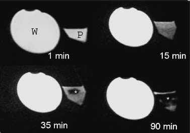 Fig. 29–12