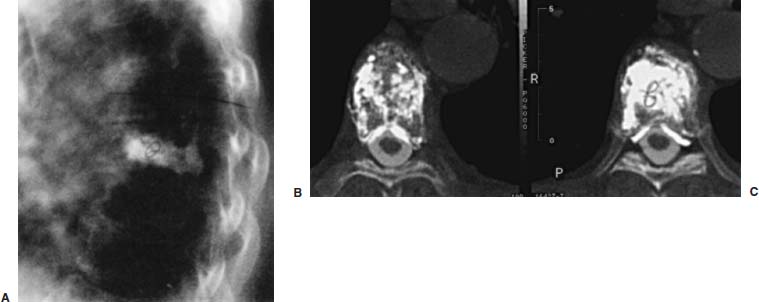 Fig. 29–13