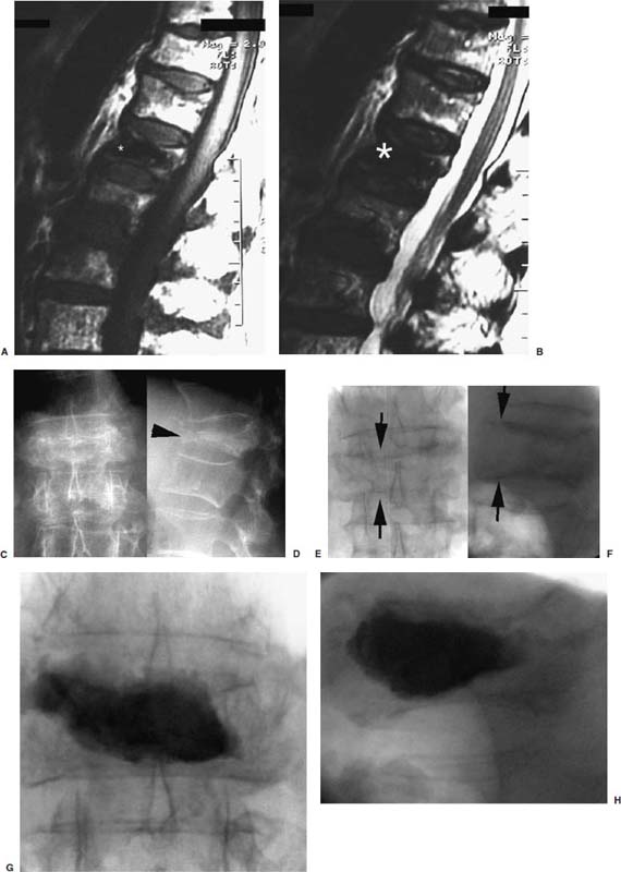 Fig. 29–14