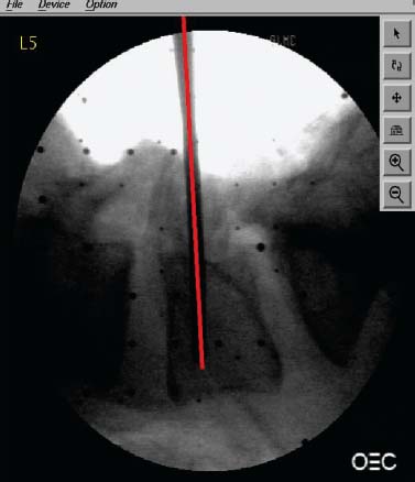 Fig. 33.3