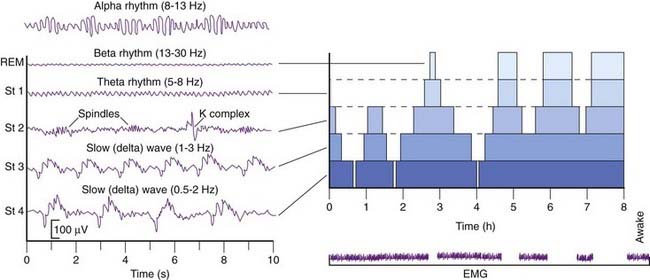 Electroencephalography | Neupsy Key