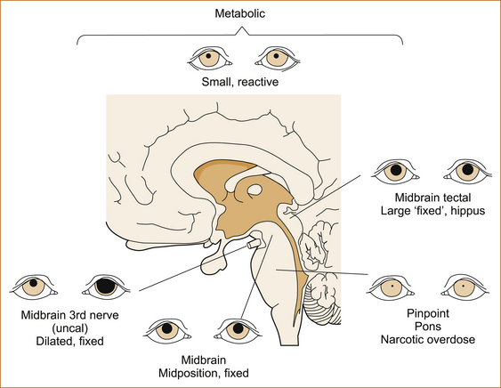 brisk pupil reaction